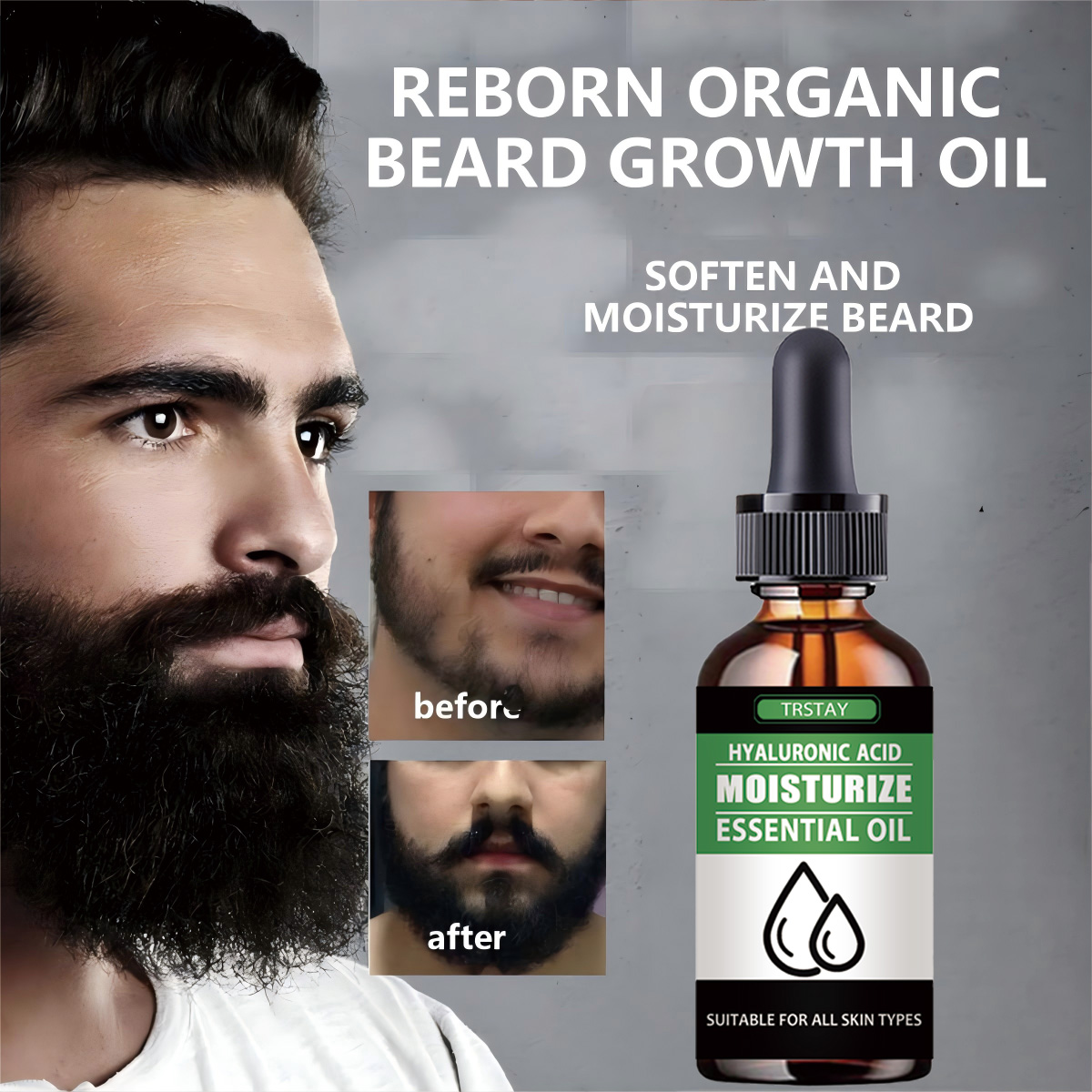 Men'S Grooming And Skin Care - 100%Natural Accelerate Facial Hair Grow Beard